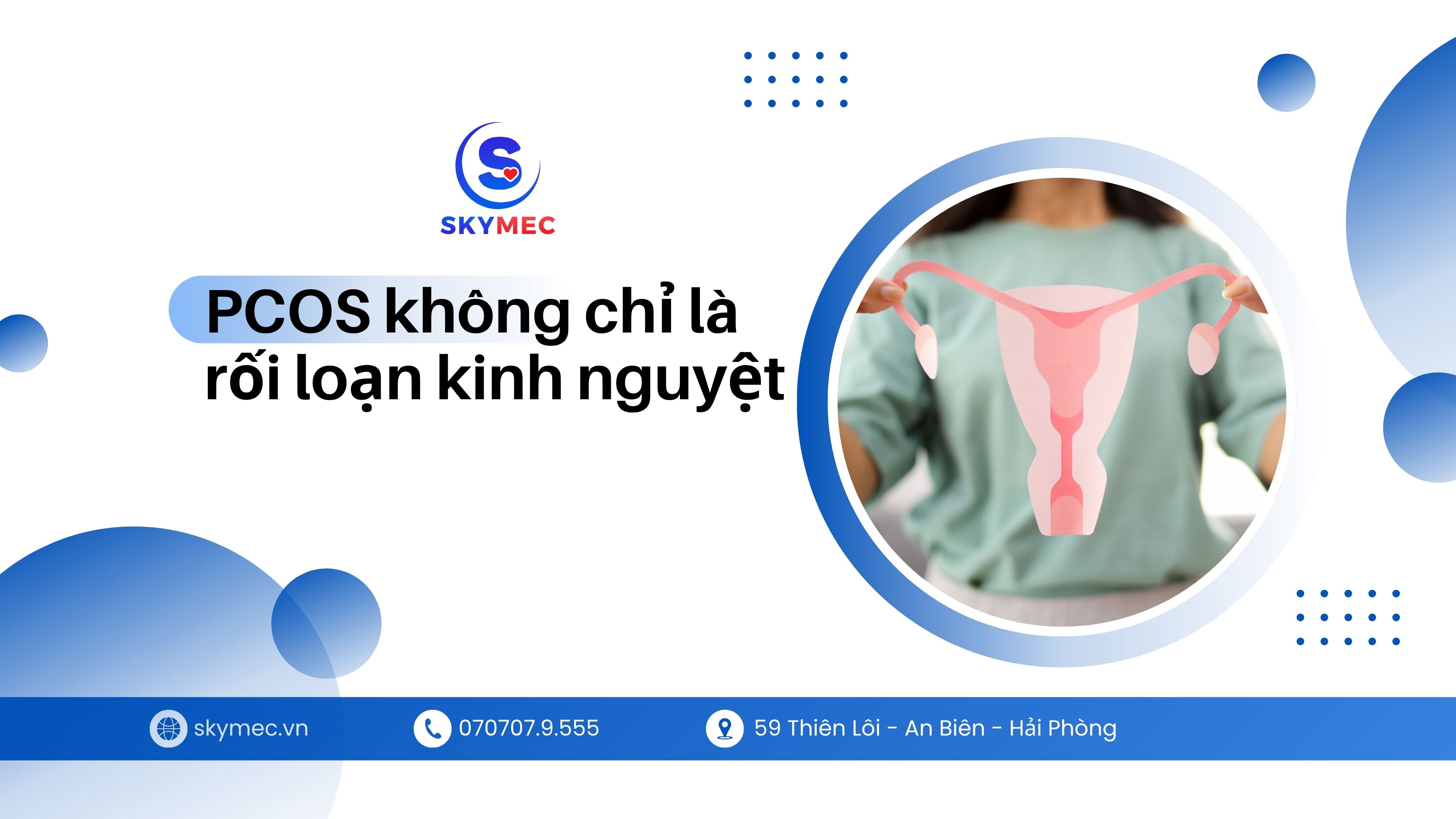 PCOS không chỉ là rối loạn kinh nguyệt